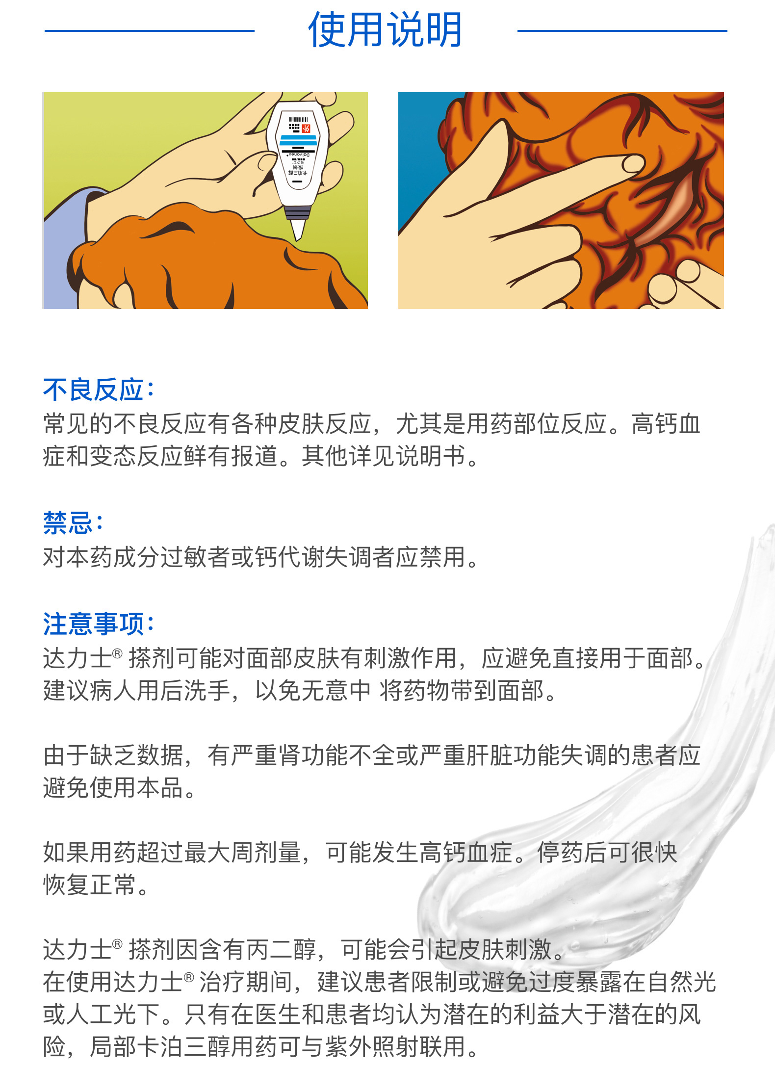 卡泊三醇搽剂(达力士)(卡泊三醇搽剂)_说明书_作用_效果_价格_方舟健