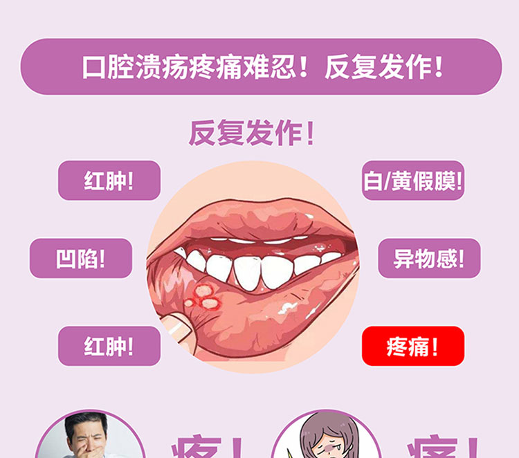 曲安奈德口腔软膏宁之助